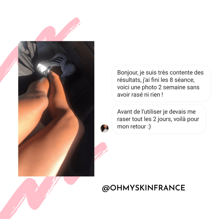Ohmyskin épilateur à lumière pulsée